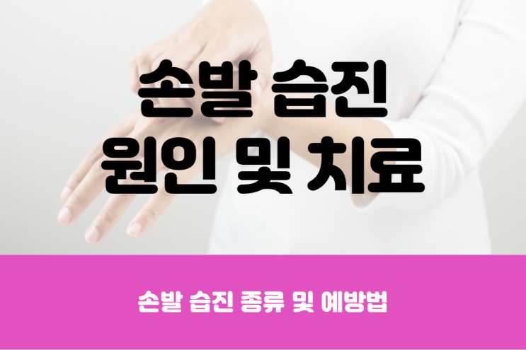  손 습진 및 발 습진 원인