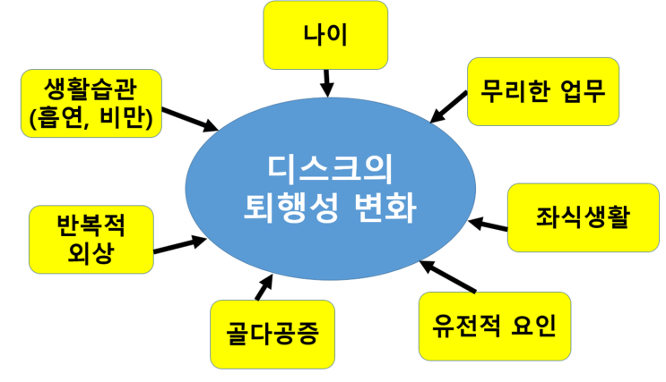  10대 20대에도 디스크가 오나요?? (디스크의 원인)