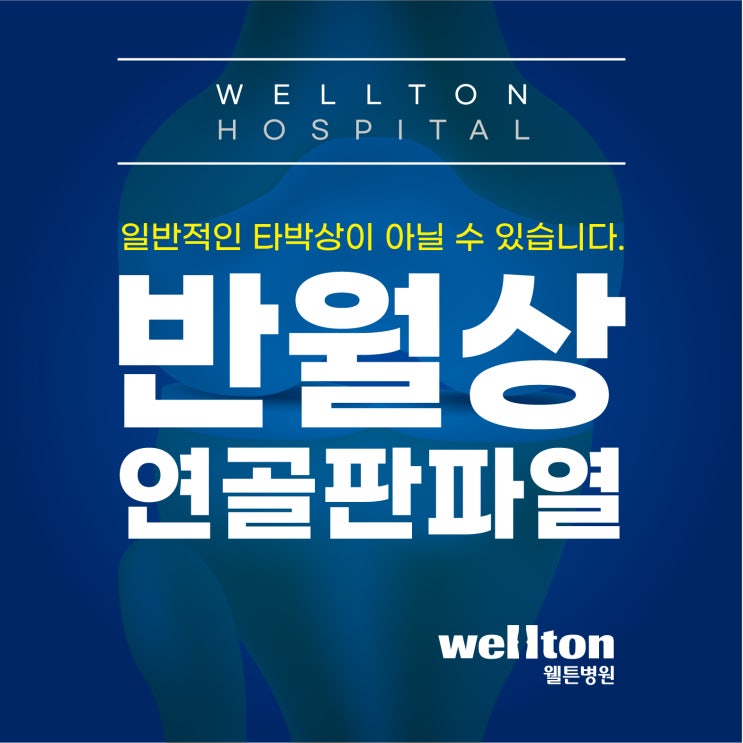  마곡정형외과, 반월상연골파열 일반 타박상이 아닙니다.