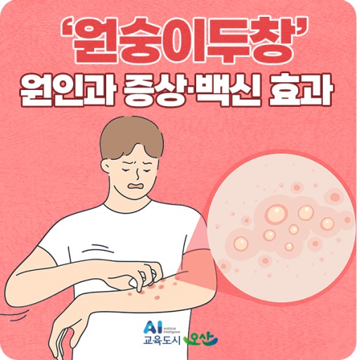  코로나에 이어..원숭이두창이라니....