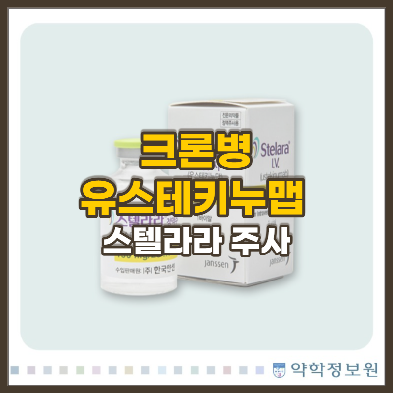 크론병 환자를 위한 우스테키누맙(스텔라라) 주사 치료