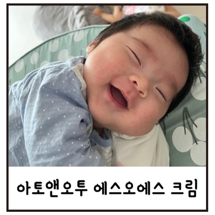  아토앤오투 sos크림으로 우리 아기피부 지켜줘요!