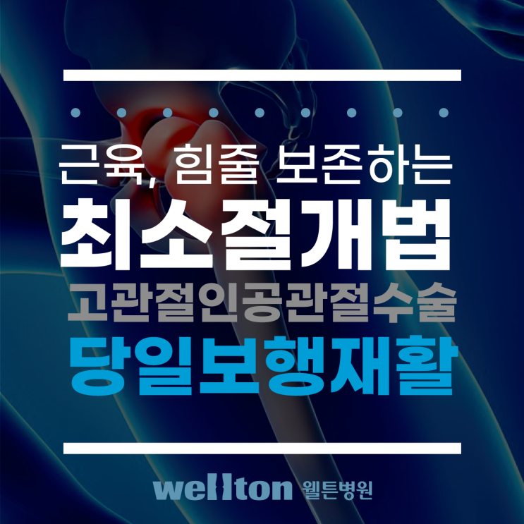  근육, 힘줄 보존하는 최소절개 고관절인공관절수술 장점