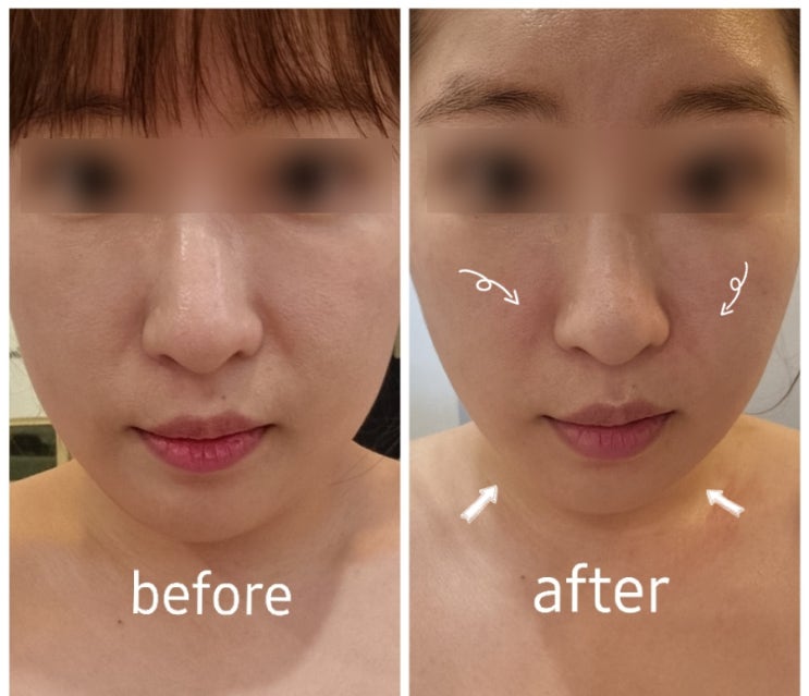  [사당동&남성역피부관리] "윤스킨앤바디연구소" 이중턱, 비대칭,리프팅관리/홀리스틱아로마윤곽테라피/작은얼굴, 윤곽관리/도테라오일아로마/뱀부테라피