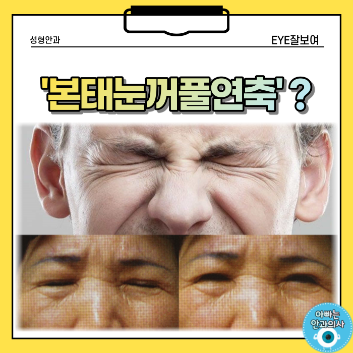  점점 눈을 뜨기가 어려워진다면?! - 본태눈꺼풀연축 (1)