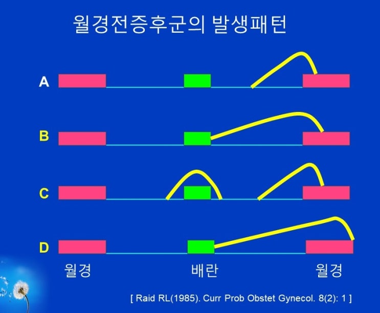  월경전증후군 PMS, Premenstrual syndrome(생리전증후군)원인과 운동, 월경전불쾌장애 PMDD
