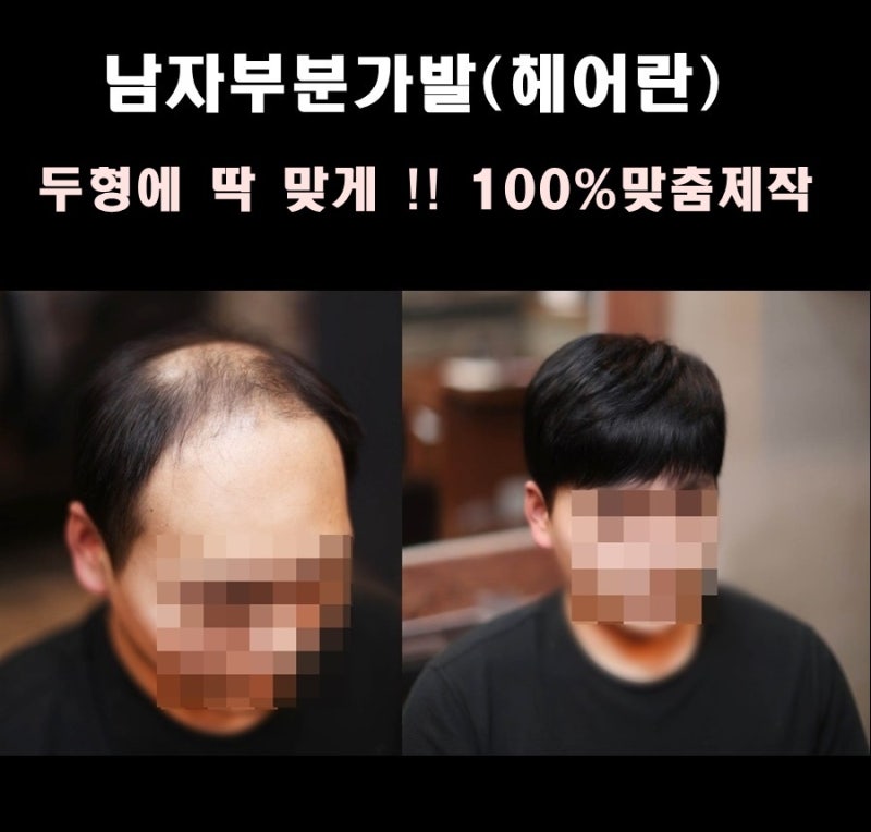 남자맞춤가발 사이즈측정팁 남자맞춤가발 사이즈측정팁