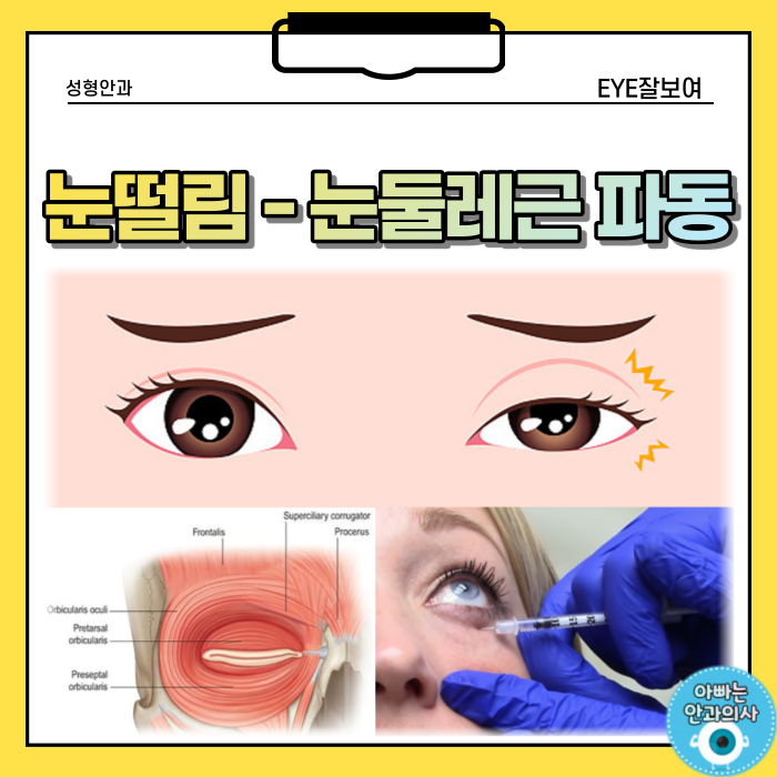 갑자기 ‘파르르’눈떨림, 눈꺼풀떨림 - 마그네슘 꼭 먹어야 할까?