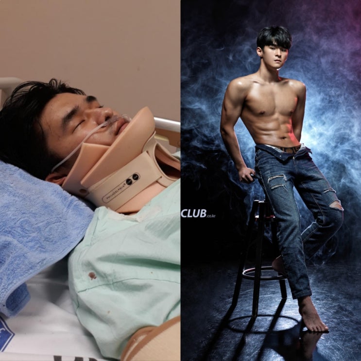 오토바이 교통사고로 중환자실까지 갔었지만 헬스를 통해 극복한 내 몸의 변화 과정(여러분도 할 수 있습니다.)
