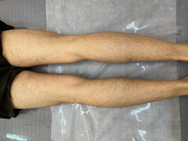  [대전 도안동 _히멜뷰티] 대전 도안동에 위치한 남성 다리 왁싱 깔끔하게 하는 히멜뷰티샵