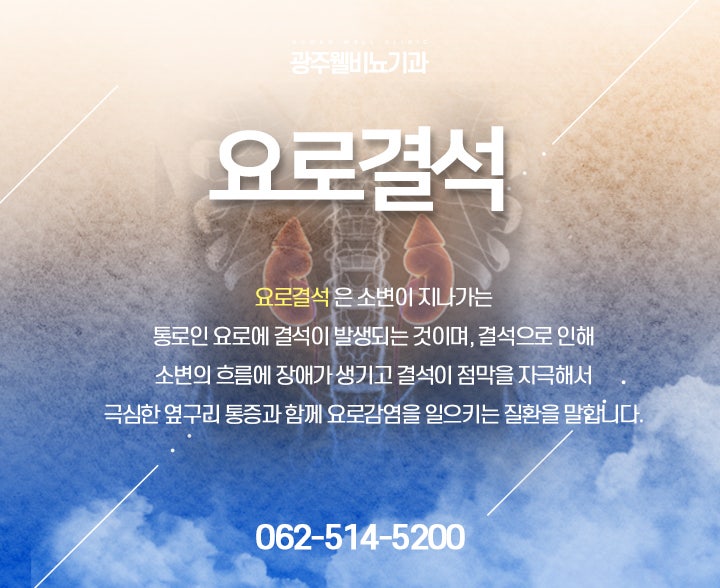광주요로결석 통증으로 힘들면 [증상, 치료법, 예방법] 3