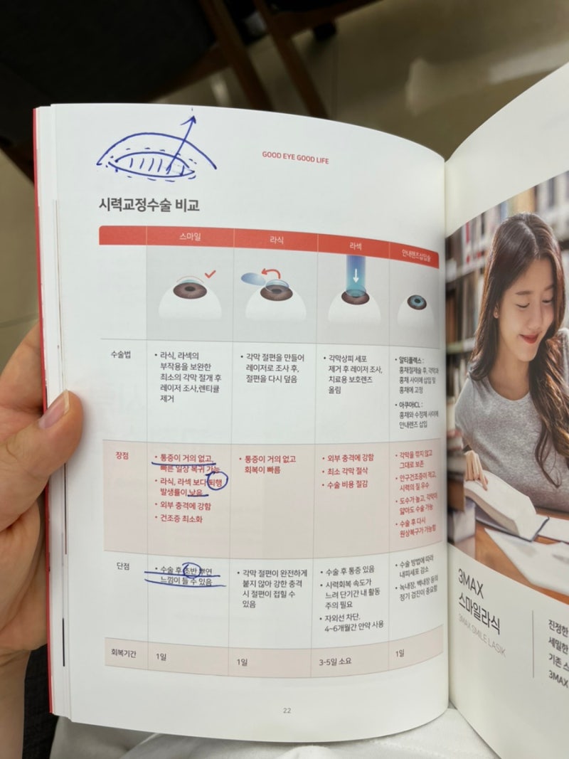 라식수술 후기/내돈내산/나안과/천안라식/노안/천안안과/40대 라식/1일차/2일차/3일차 7