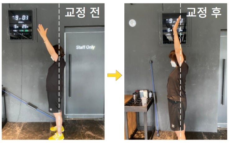  불당동헬스/어깨통증케어/오십견/비포에프터/운동전후/러쉬피트니스