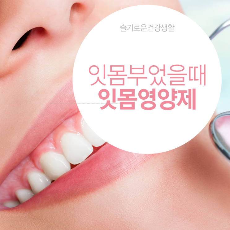  잇몸 부었을때 내려앉음 원인 잇몸영양제 덴티시브