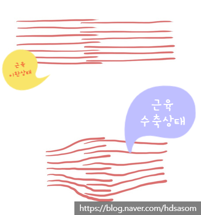  이마 보톡스 후 눈 처짐 이유 - 삼성중앙역 피부과 전문의 닥터림