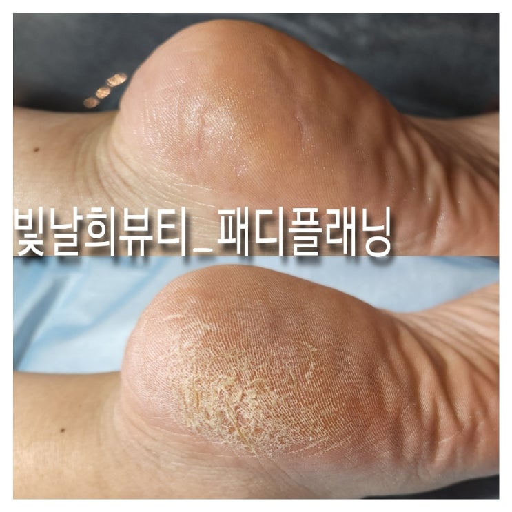  양산패디플래닝 빛날희왁싱에서 부모님 효도시켜드리기!
