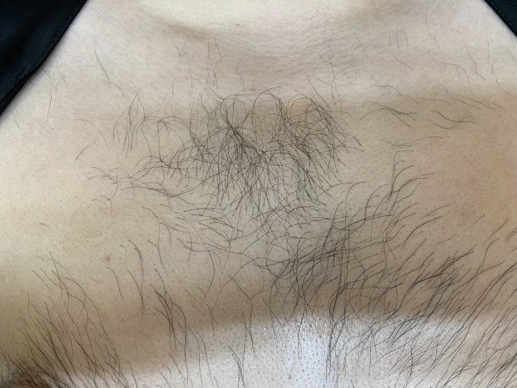  [ 대전도안동왁싱 _히멜뷰티 ] 도안동왁싱통증 덜어주는 히멜뷰티