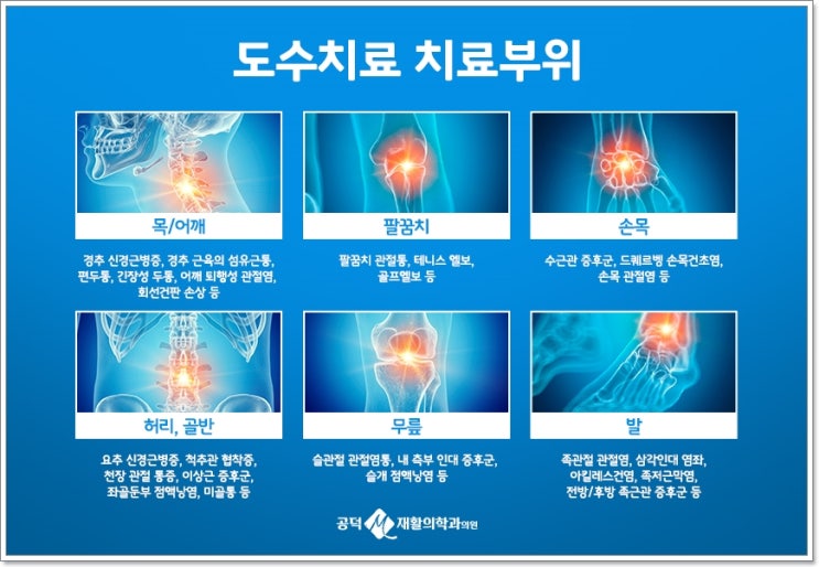  도화동정형외과 치료는 어떤 방식으로?