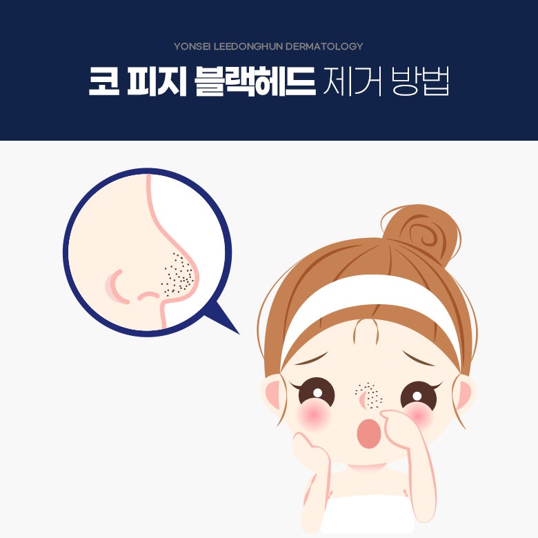 조례동 연세이동훈피부과 코 피지 블랙헤드 발생 원인과 제거방법은?