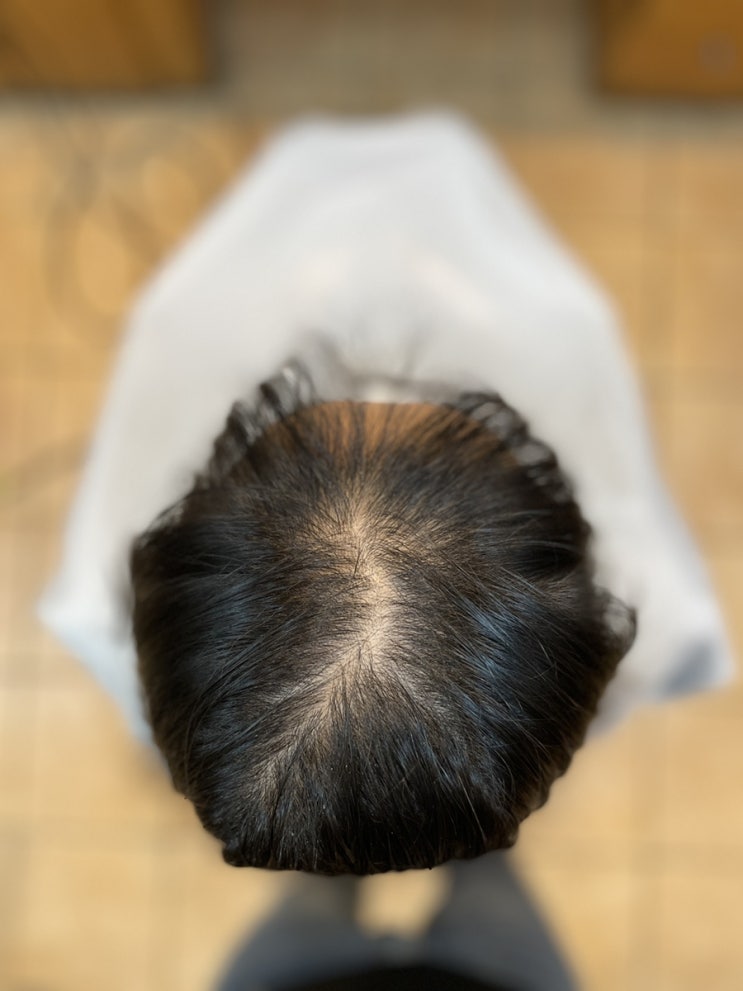  부산찍고 강원도에서 제주도까지 탈모커버성형펌 방문 러쉬!/ 마산창원김해가야녹산울산양산명지거제밀양통영대구구미강원제주전라충청경주