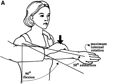 O'Brien test / Active compression test : 오브라이언테스트 / 능동 압박 검사 - SLAP 병변 ...