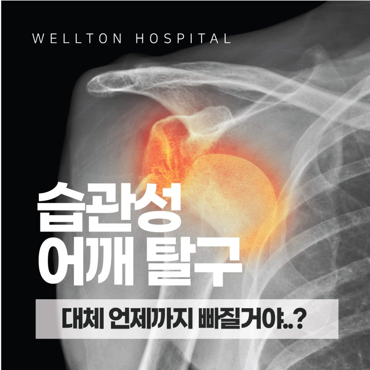  발산동정형외과 습관성 어깨 탈구 치료받고 불안감에서 해방되세요!