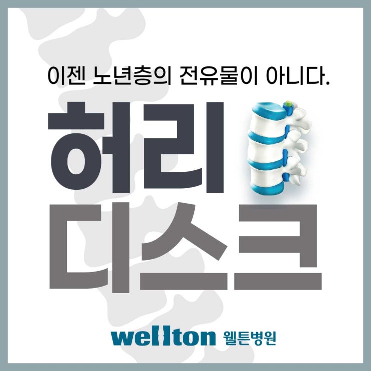 마곡역정형외과, 허리디스크 초기에 도수치료