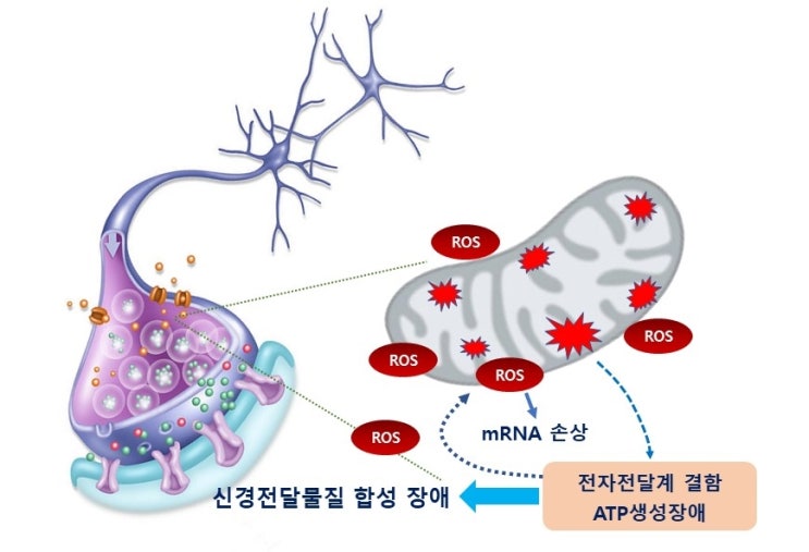  피로이야기(6), 만성피로, 자율신경부전과 활성산소, 근막통증증후군