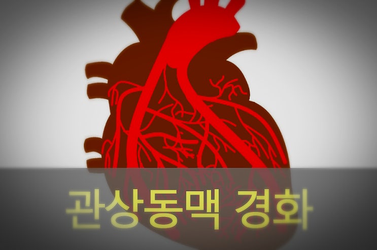  심장질환 원인 관상동맥 경화증을  알아보자!