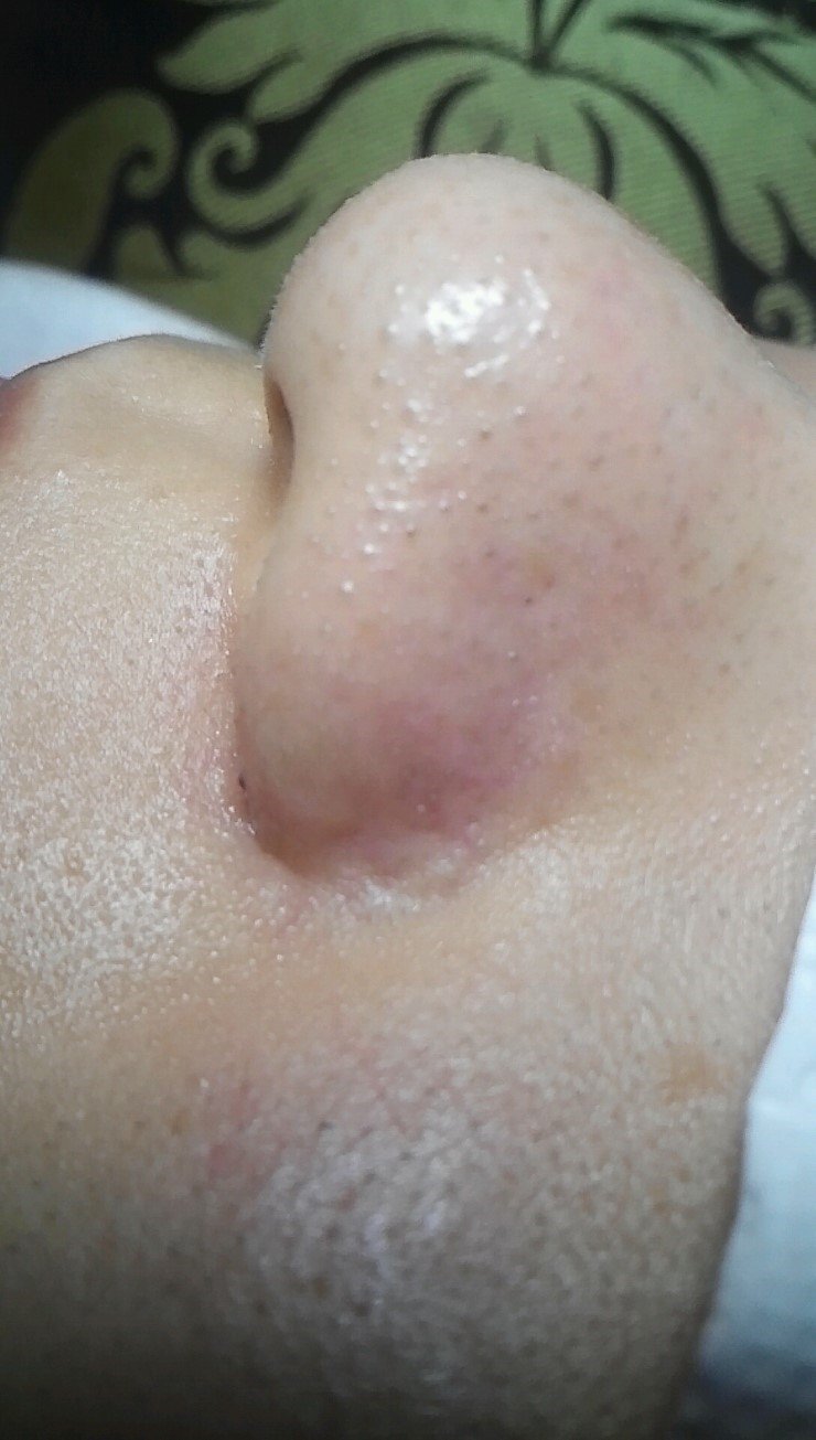  얼굴 각질제거로 피부좋아지는법