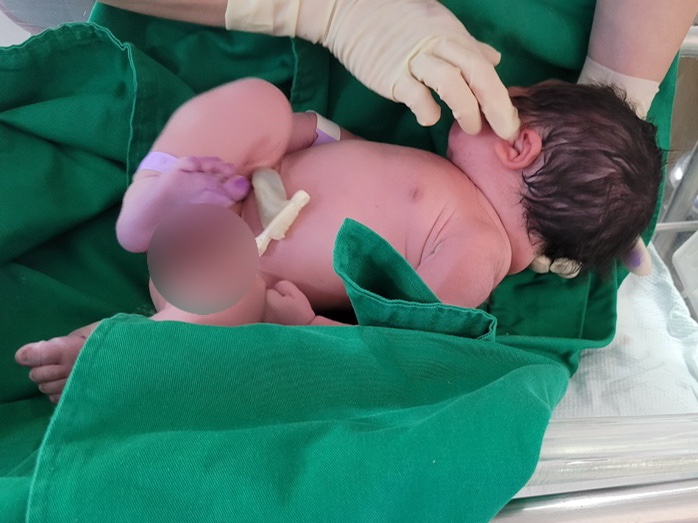 포항여성아이병원 제왕절개 수술 출산 후기 (입원 1인실, 4kg 신생아)
