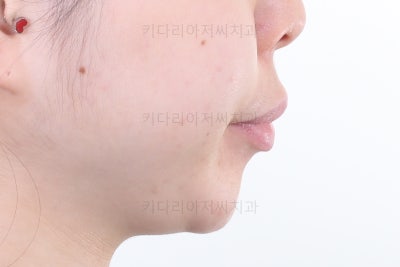 부산연산동치과의원을 조직하면서 3