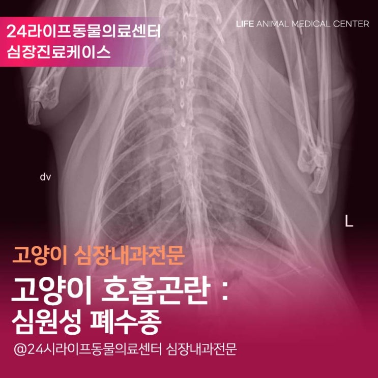 대구 고양이 심장 동물병원 : 고양이 호흡곤란 고양이 심원성 폐수종 24시라이프동물의료센터