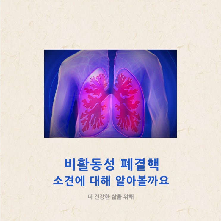  비활동성 폐결핵 소견에 대해 알아볼까요?