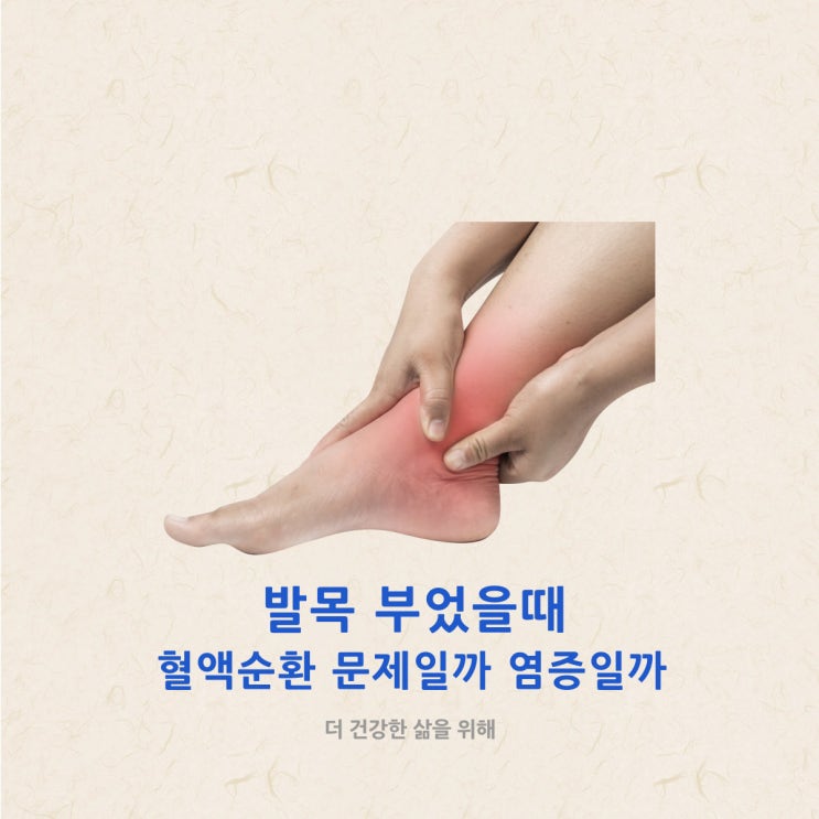  발목 부었을때 혈액순환 문제일까 염증일까