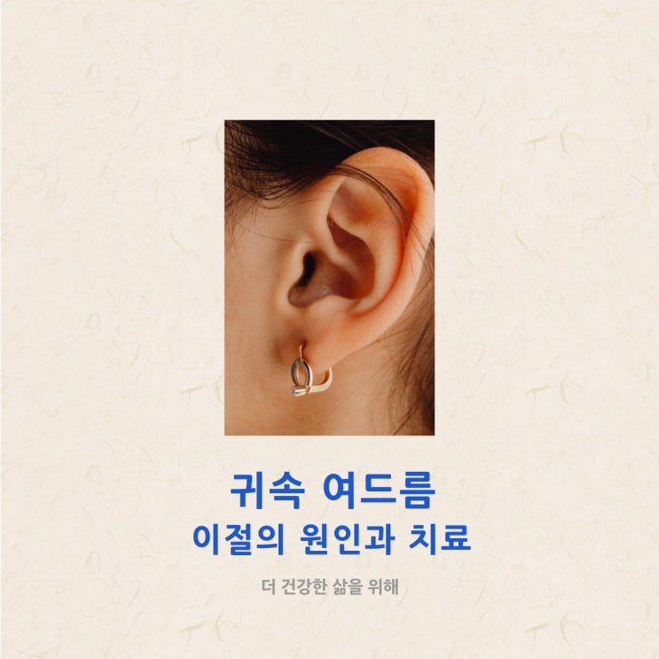  귀속 여드름 이절의 원인과 치료