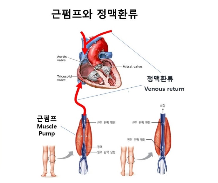  하지정맥류 Varicose veins의 운동방법과 주의사항, 정맥판막, 정맥저류, 정맥환류