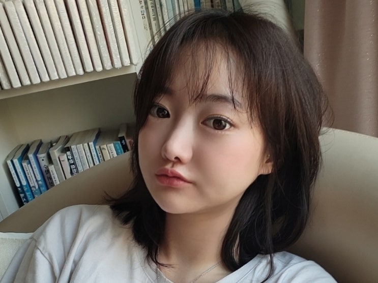  무통증리프팅 개인적으로 효과가 제일 좋았던 티타늄리프팅 후기