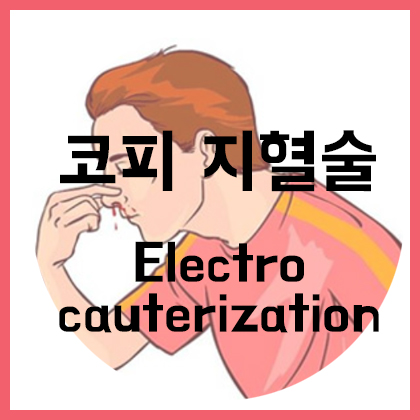  [코] 코피 지혈술(Electrocauterization)