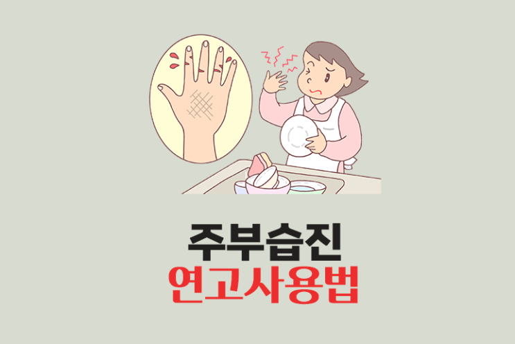  주부습진 연고 사용법