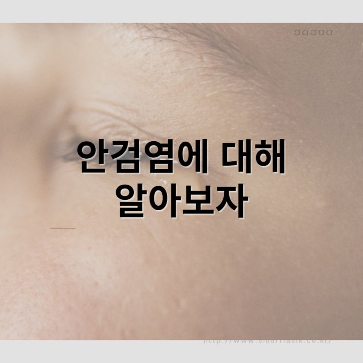  안검염은 무엇인가? 원인과 증상 그리고 예방법 및 치료방법