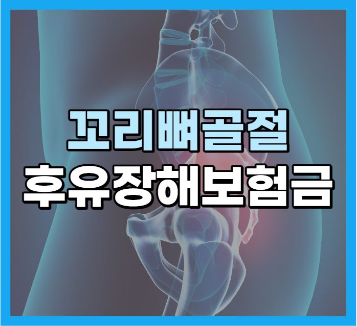  꼬리뼈골절 후유장해 보험금 검토하세요