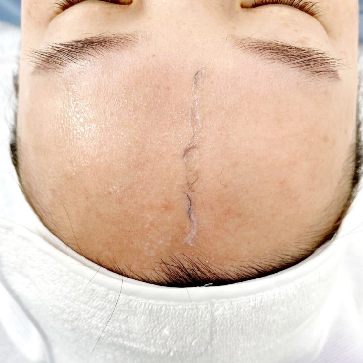  서연네일 앤 속눈썹 - 울산 남구 무거동 스킨플래닝 뷰티샵 (메이크업이 잘 안먹힌다면? 스킨플래닝이 답이죠~)