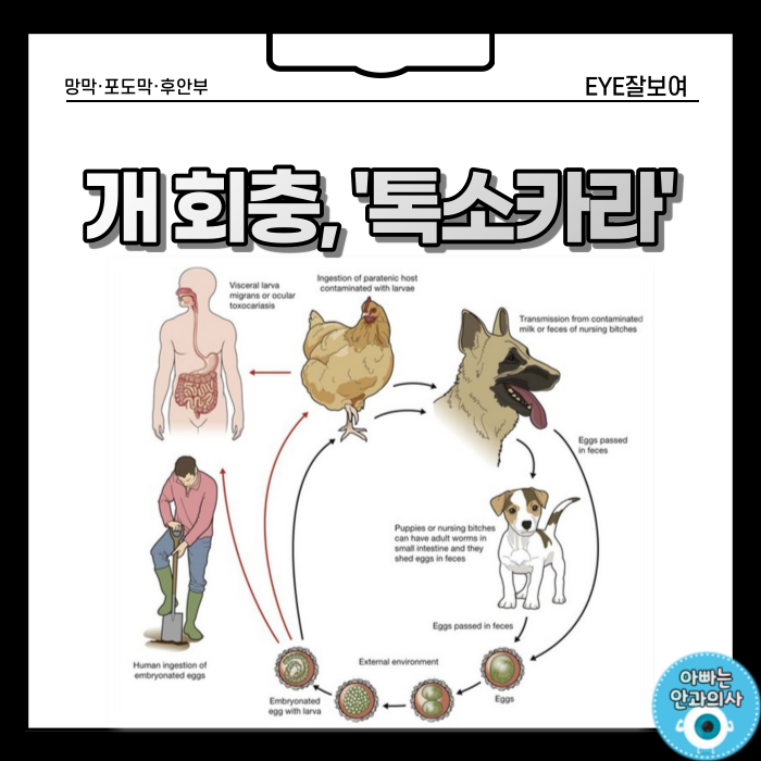  개(강아지)회충, 고양이기생충 - '톡소카라(Toxocara)'