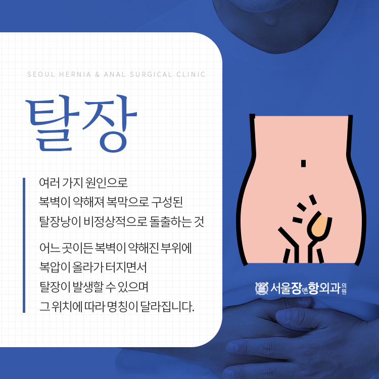 성인 탈장 수술 증상에서 치료 방법을 알아보다