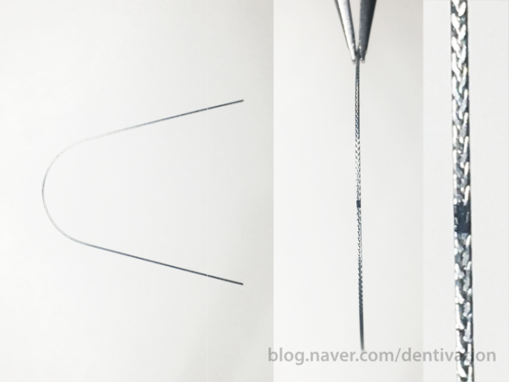  [치과 소재료] D-rect, 디렉트, Braided, 브레이디드 와이어