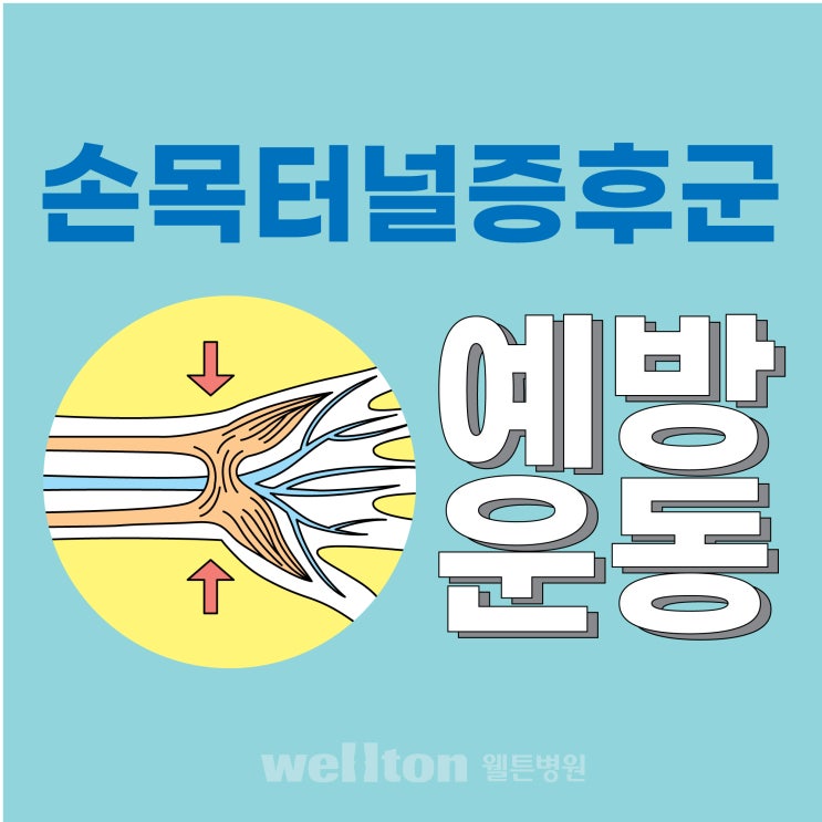  마곡정형외과 미리 손목운동하고 손목터널증후군 예방하세요.
