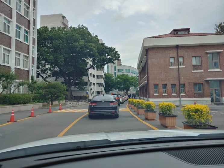  매복 사랑니 발치 후기