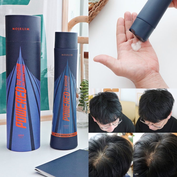  탈모샴푸추천 직접 써보니 할만해