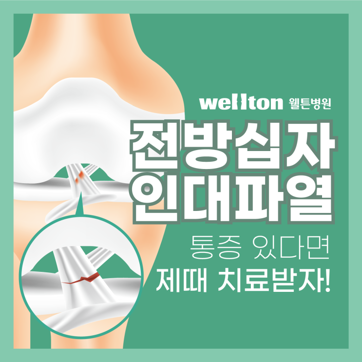  전방십자인대파열 통증 참지말고, 제때 치료받자